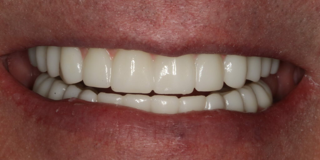 Smile Gallery Hildebran