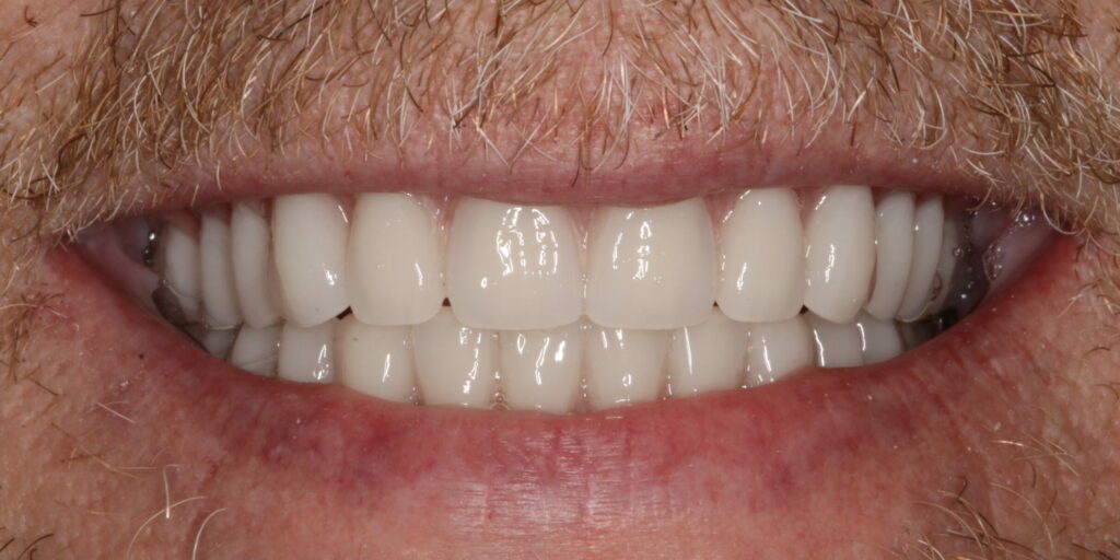 Smile Gallery Hildebran