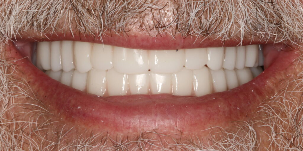 Smile Gallery Hildebran