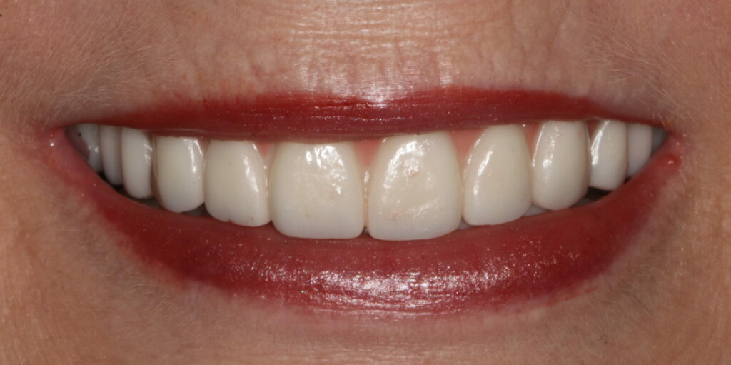 Smile Gallery Hildebran